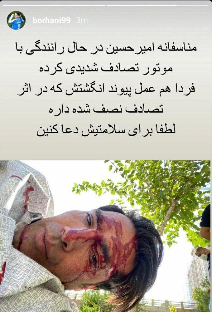 (عکس) تصادف وحشتناک امیرحسین صادقی مدافع سابق استقلال (عکس) تصادف وحشتناک امیرحسین صادقی مدافع سابق استقلال