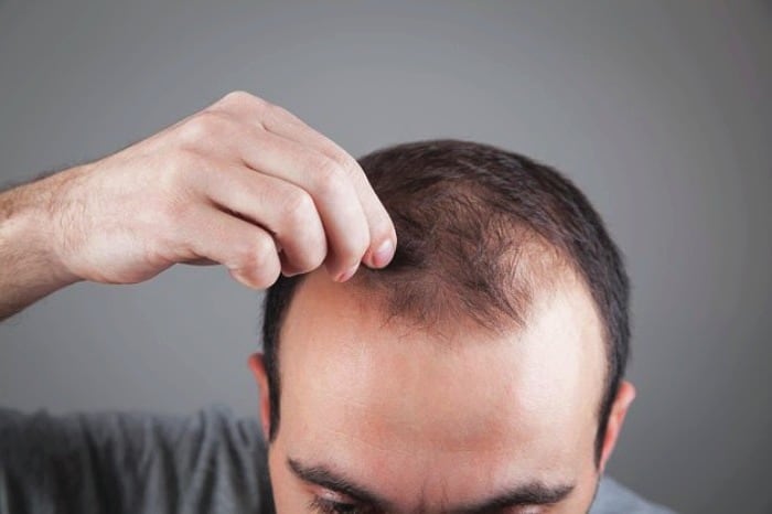 جلوگیری از ریزش مو