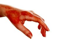 روشی برای رشد مجدد پوست انسان پس از سوختگی شدید