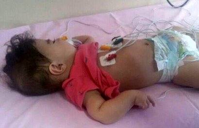 داروی سه میلیارد تومانی دریچه امیدی برای زنده ماندن رادین است