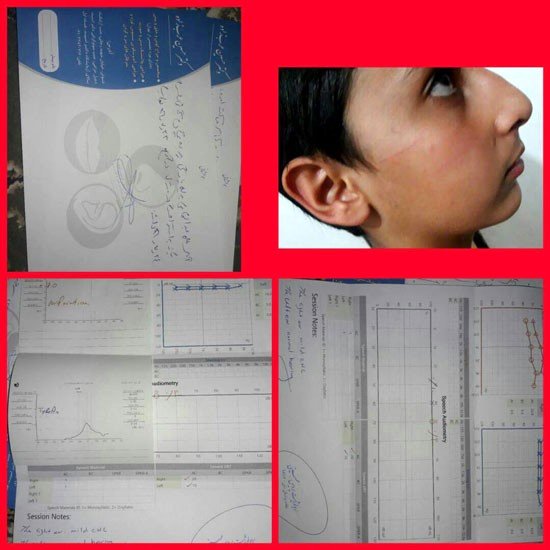 سیلی ناظم، گوش دانش آموز را پاره کرد!