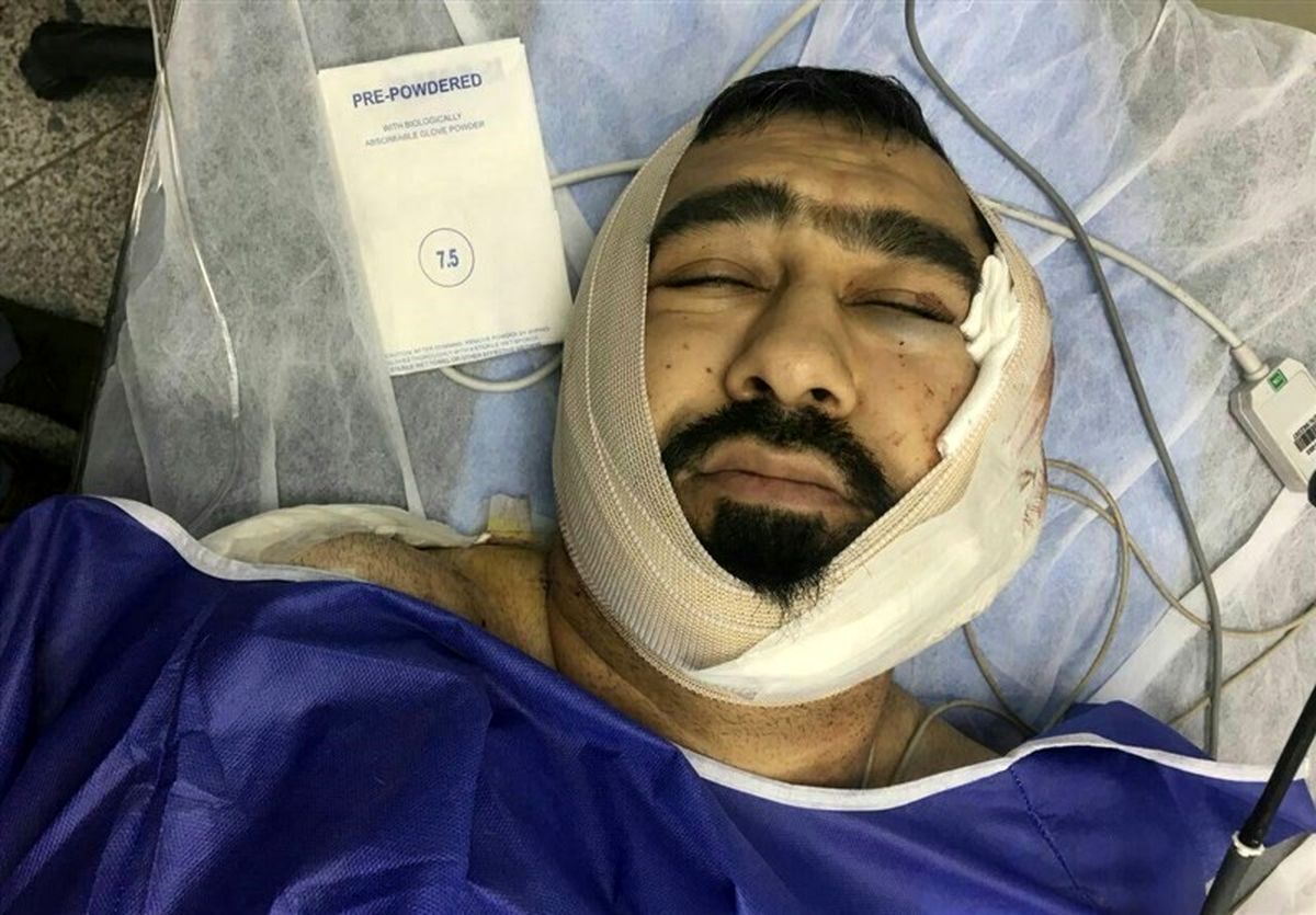 آخرین وضعیت "طلبه تهرانی" که با ضربات قمه یک اوباش مجروح شد
