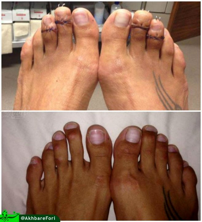 عمل جراحی سیندرلا هم مد شد!