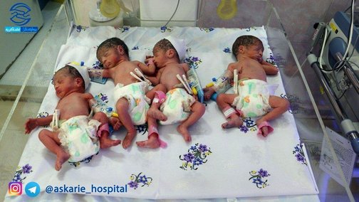 به دنیا آمدن 4قلوهای چادگانی