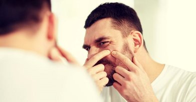 هر آنچه باید درباره درمان جوش صورت و آکنه بدانید