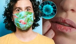 تغییرات عجیب لب‌ها بر اثر ابتلا به ویروس کرونا / عکس