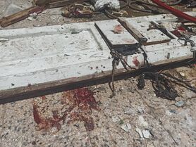 انفجار گاز در یک کارگاه خیاطی حادثه آفرید/ ۵ نفر مصدوم شدند + تصاویر