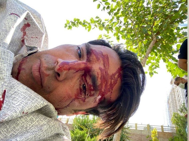 (عکس) تصادف وحشتناک امیرحسین صادقی مدافع سابق استقلال