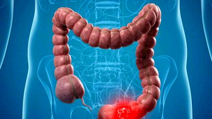علل درد دور ناف و راه‌های درمان آن