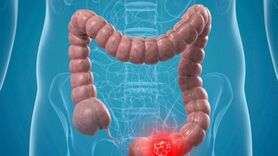 علل درد دور ناف و راه‌های درمان آن
