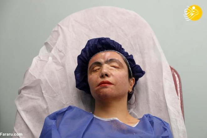 (تصاویر) فعالیت معصومه عطایی قربانی اسیدپاشی در مدلینگ