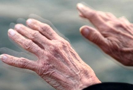 ویتامین‌هایی که مانع پیشرفت پارکینسون می‌شوند