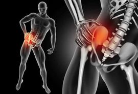 کلاپس مفصل ران چیست و چه دلیلی دارد؟