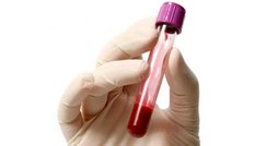 چگونه با تغذیه صحیح کم خونی را درمان کنیم؟