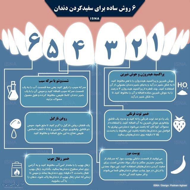 اینفوگرافی / ۶ روش ساده برای سفیدکردن دندان
